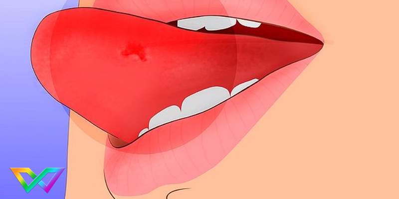 can-vao-luoi-la-diem-gi-danh-con-gi-de-trung